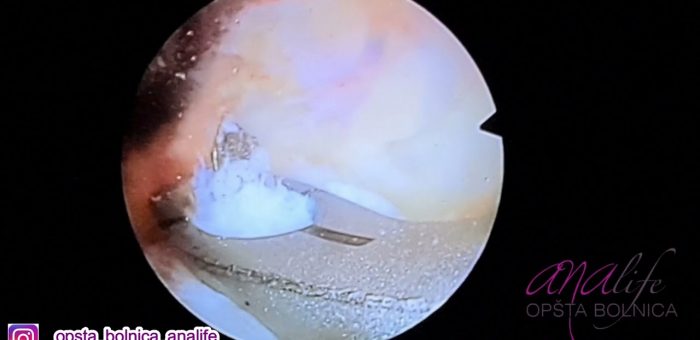 Hipokrat – Ana life 7 (TV KCN)