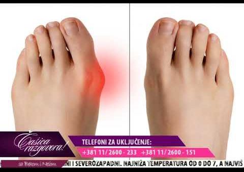Casica razgovora – Dr Goran Lekic – specijalista ortopedije ( TV KCN 14.10.2021.)