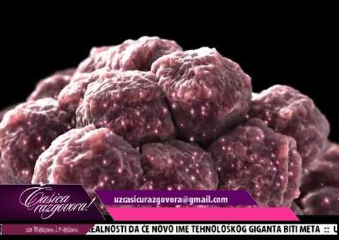 Casica razgovora – Dr Uros Kenic – urolog ( TV KCN 29.10.2021.)