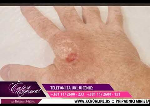 Casica razgovora – Prof. Dr Milan Jovanovic ( TV KCN 19.05.2022.)