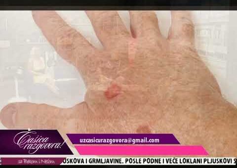 Casica razgovora – Prof. dr Milan Jovanovic (TV KCN 23.06.2022)